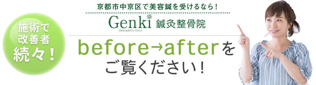 Genki鍼灸整骨院の美容鍼before & after