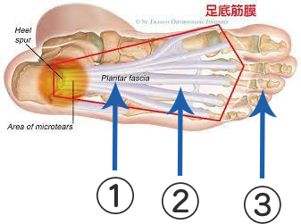 足底筋膜図解